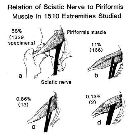 piriformis